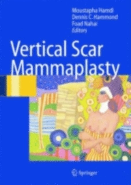 Foad Nahai, Dennis C. Hammond, Moustapha Hamdi - Vertical Scar Mammaplasty, E-bok