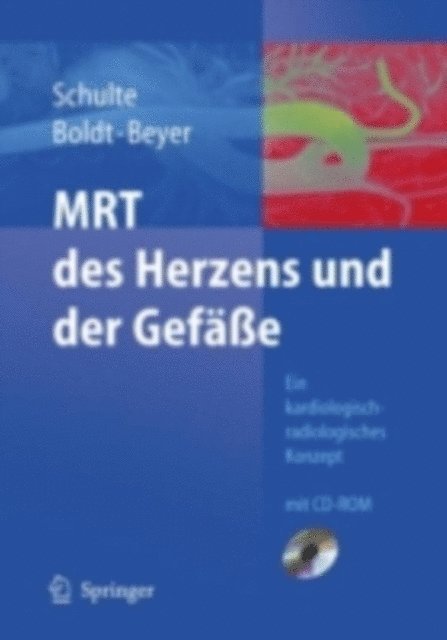 D. Beyer, A. Boldt, B. Schulte - MRT des Herzens und der Gefäße, E-bok