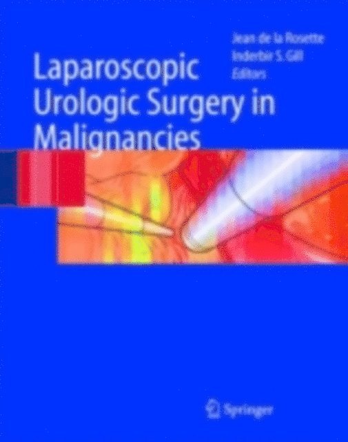 Inderbir S. Gill, Jean J.M.C.H. de la Rosette - Laparoscopic Urologic Surgery in Malignancies, E-bok