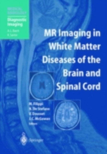 Joseph C. McGowan, Vincent Dousset, Nicola de Stefano, Massimo Filippi - MR Imaging in White Matter Diseases of the Brain and Spinal Cord, E-bok