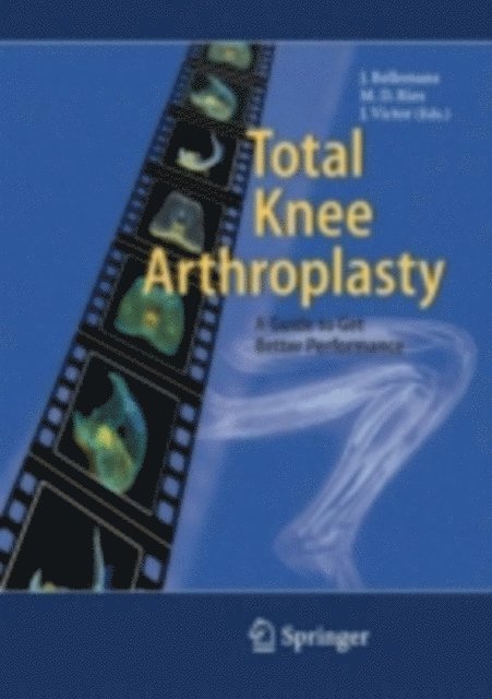 Jan M.K. Victor, Michael D. Ries, Johan Bellemans - Total Knee Arthroplasty, E-bok