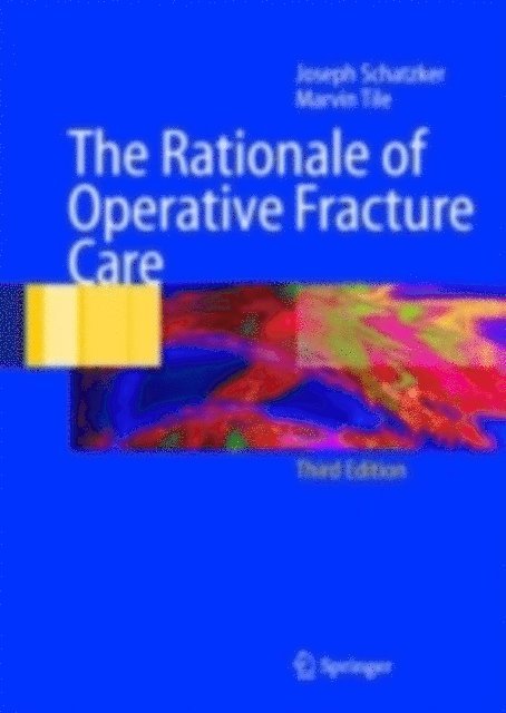 Marvin Tile, Joseph Schatzker - Rationale of Operative Fracture Care, E-bok