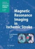 Magnetic Resonance Imaging in Ischemic Stroke