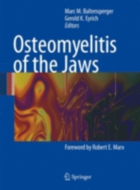 Gerold K. Eyrich, Marc Baltensperger - Osteomyelitis of the Jaws, E-bok. Tillgänglighet: Lägg i varukorg
