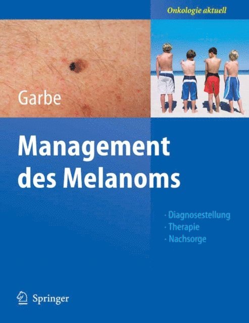 Claus Garbe - Management des Melanoms, E-bok