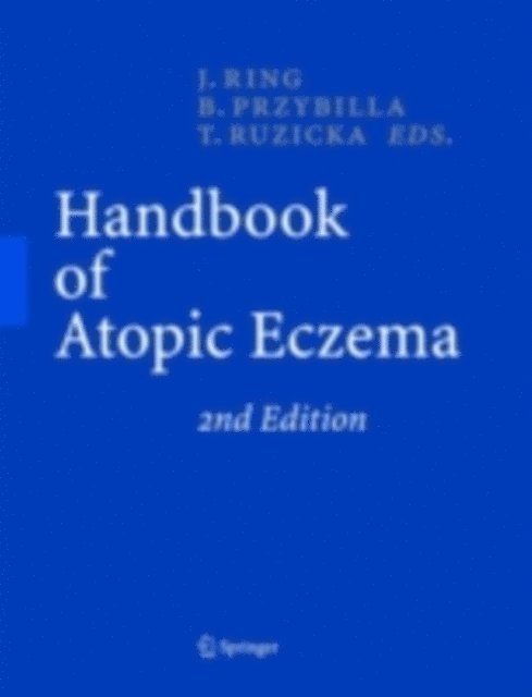 Thomas Ruzicka, Bernhard Przybilla, Johannes Ring - Handbook of Atopic Eczema, E-bok
