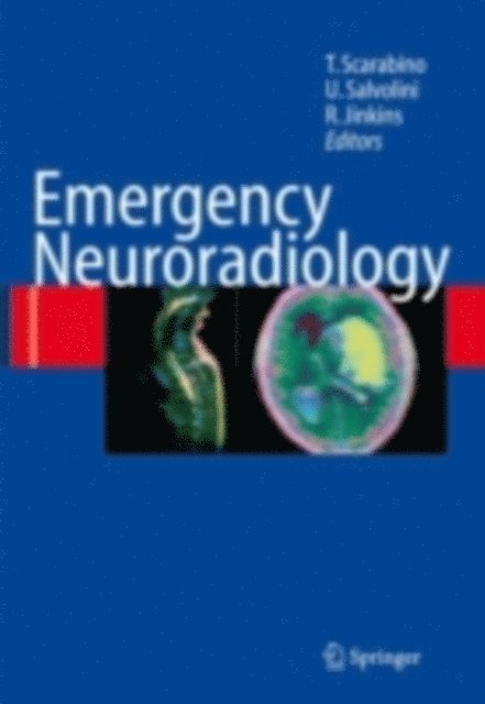 Randy J. Jinkins, Ugo Salvolini, Tommaso Scarabino - Emergency Neuroradiology, E-bok