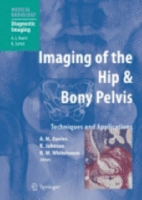 Richard William Whitehouse, Karl J. Johnson, A. Mark Davies - Imaging of the Hip & Bony Pelvis, E-bok