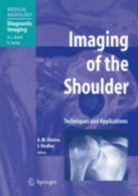 A. Mark Davies - Imaging of the Shoulder, E-bok