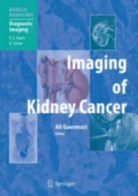 Ali Guermazi - Imaging of Kidney Cancer, E-bok