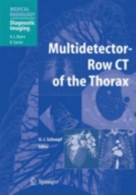 U. Joseph Schoepf - Multidetector-Row CT of the Thorax, E-bok