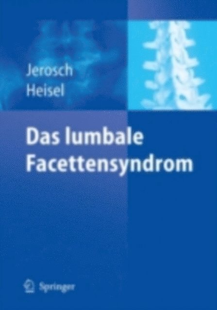 Jurgen Heisel, Jorg Jerosch - Das lumbale Facettensyndrom, E-bok