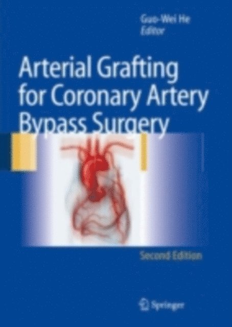 Guo-Wei He - Arterial Grafting for Coronary Artery Bypass Surgery, E-bok. Tillgänglighet: Lägg i varukorg