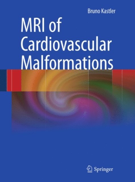 Bruno Kastler - MRI of Cardiovascular Malformations, E-bok