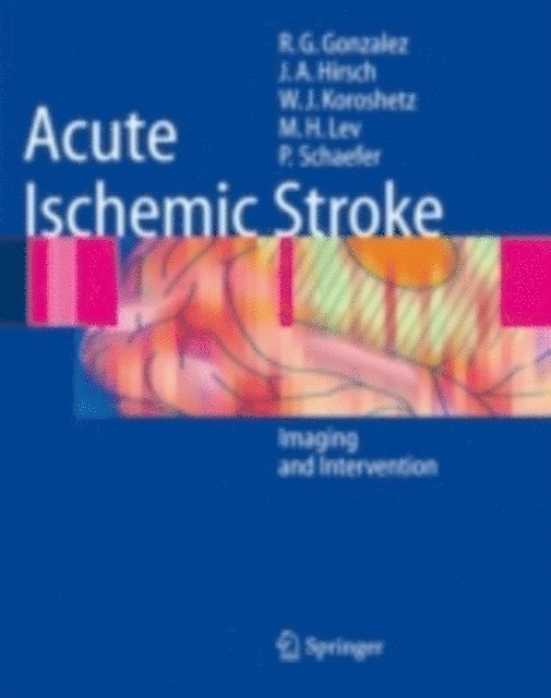 Lee  H. Schwamm, Pamela W. Schaefer, Michael H. Lev, Joshua A. Hirsch, R. Gilberto Gonzalez - Acute Ischemic Stroke, E-bok