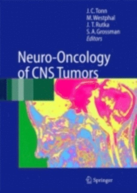 S.A. Grossman, J. T. Rutka, Manfred Westphal, Jorg-Christian Tonn - Neuro-Oncology of CNS Tumors, E-bok