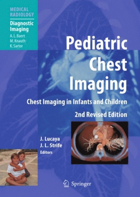 Janet L. Strife, Javier Lucaya - Pediatric Chest Imaging, E-bok