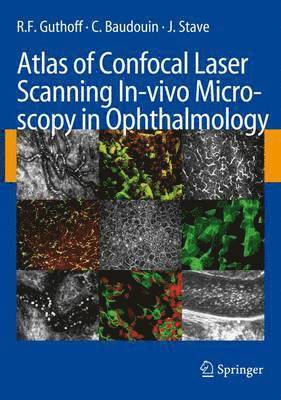 Atlas of Confocal Laser Scanning In-vivo Microscopy in Ophthalmology av R F Guthoff, C Baudouin, J Stave
