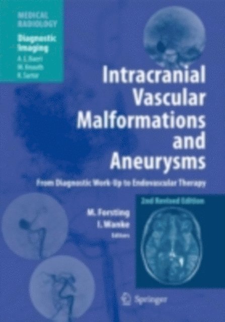 Isabel Wanke, Michael Forsting - Intracranial Vascular Malformations and Aneurysms, E-bok