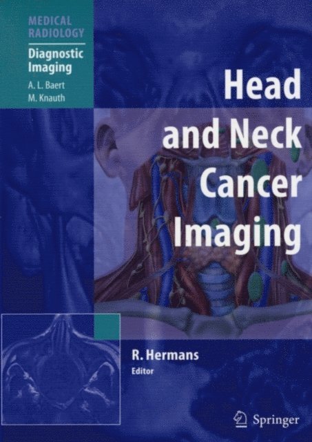 Robert Hermans - Head and Neck Cancer Imaging, E-bok