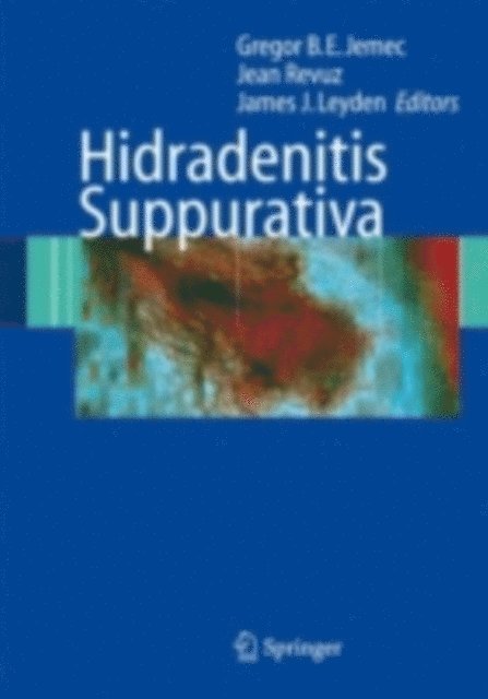James J. Leyden, Jean Revuz, Gregor Jemec - Hidradenitis Suppurativa, E-bok