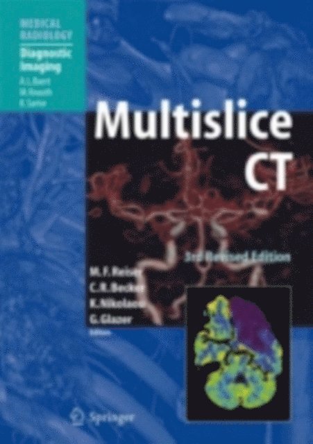 Gary Glazer, Konstantin Nikolaou, Christoph R. Becker, Maximilian F Reiser - Multislice CT, E-bok
