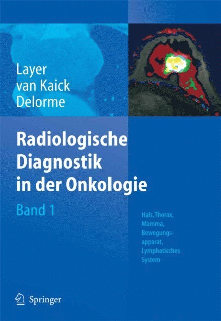 Stefan Delorme, Gerhard van Kaick, Gunter Layer - Radiologische Diagnostik in der Onkologie, E-bok