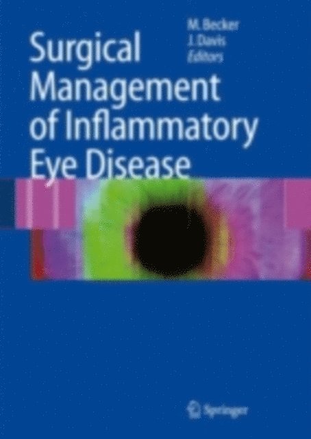 Janet Davis, Matthias D. Becker - Surgical Management of Inflammatory Eye Disease, E-bok