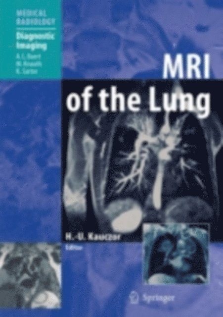 Hans-Ulrich Kauczor - MRI of the Lung, E-bok