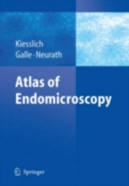 Markus F. Neurath, Peter R. Galle, Ralf Kiesslich - Atlas of Endomicroscopy, E-bok