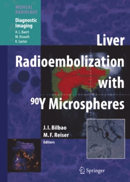 Maximilian F Reiser, Jose Ignacio Bilbao - Liver Radioembolization with 90Y Microspheres, E-bok
