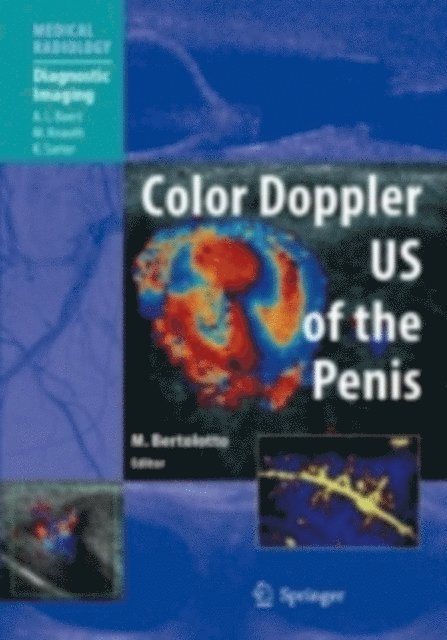 Michele Bertolotto - Color Doppler US of the Penis, E-bok. Tillgänglighet: Lägg i varukorg