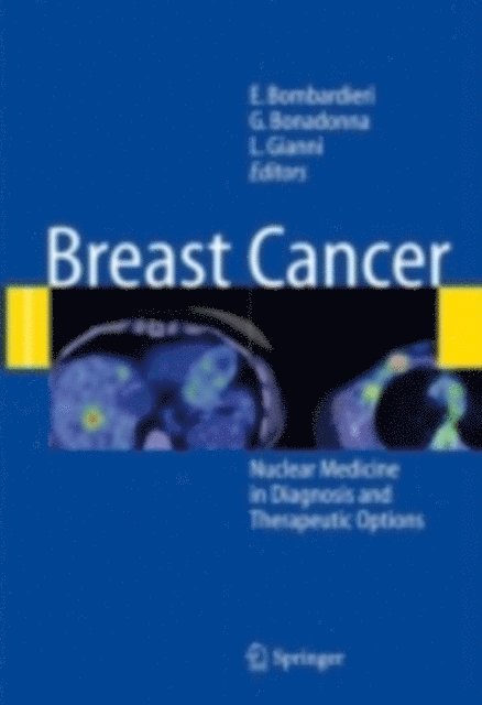 Luca Gianni, Gianni Bonadonna, Emilio Bombardieri - Breast Cancer, E-bok