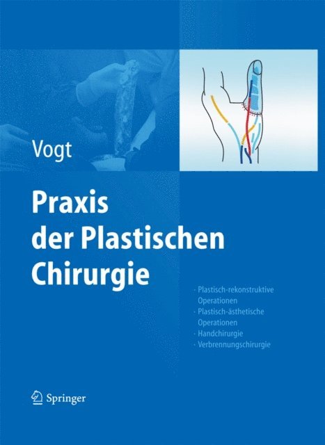 Peter M. Vogt - Praxis der Plastischen Chirurgie, E-bok