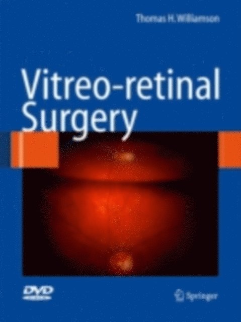 Thomas H. Williamson - Vitreoretinal Surgery, E-bok. Tillgänglighet: Lägg i varukorg