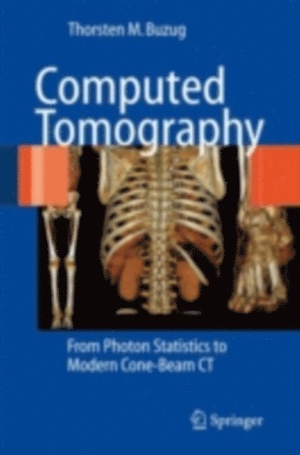 Thorsten M. Buzug - Computed Tomography, E-bok