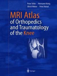 MRI Atlas of Orthopedics and Traumatology of the Knee