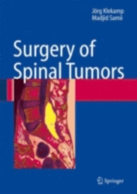 Madjid Samii, Jorg Klekamp - Surgery of Spinal Tumors, E-bok