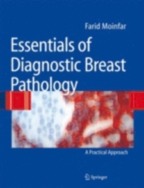 Farid Moinfar - Essentials of Diagnostic Breast Pathology, E-bok