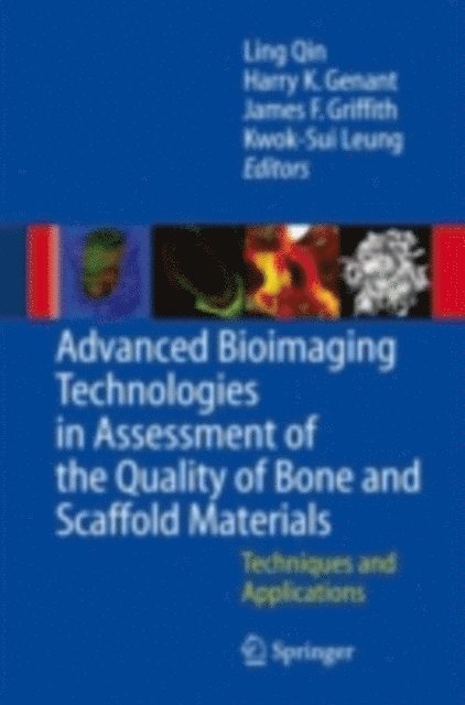 K.S. Leung, J.F. Griffith, Harry K. Genant, L. Qin - Advanced Bioimaging Technologies in Assessment of the Quality of Bone and Scaffold Materials, E-bok