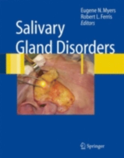 Robert L. Ferris, Eugene N. Myers - Salivary Gland Disorders, E-bok