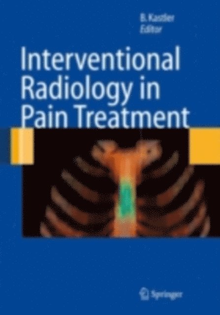 Bruno Kastler - Interventional Radiology in Pain Treatment, E-bok