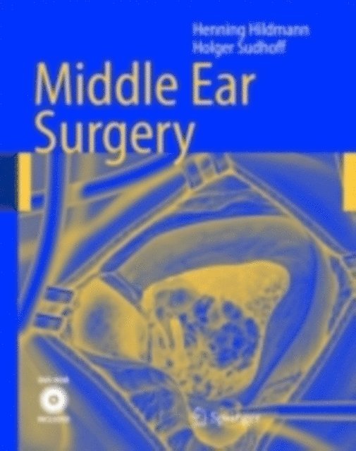 Holger Sudhoff, Henning Hildmann - Middle Ear Surgery, E-bok