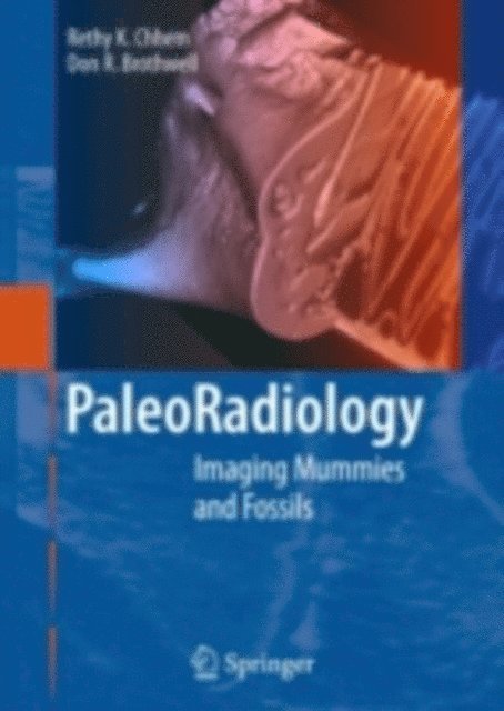 D.R. Brothwell, R.K. Chhem - Paleoradiology, E-bok