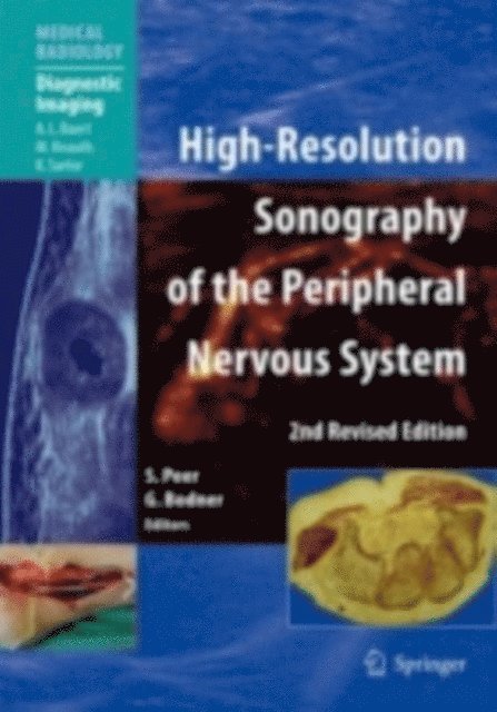 Gerd Bodner, Siegfried Peer - High-Resolution Sonography of the Peripheral Nervous System, E-bok