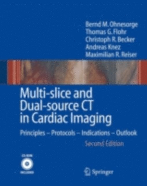 Maximilian F Reiser, Andreas Knez, Christoph R. Becker, Thomas G. Flohr, Bernd M. Ohnesorge - Multi-slice and Dual-source CT in Cardiac Imaging, E-bok