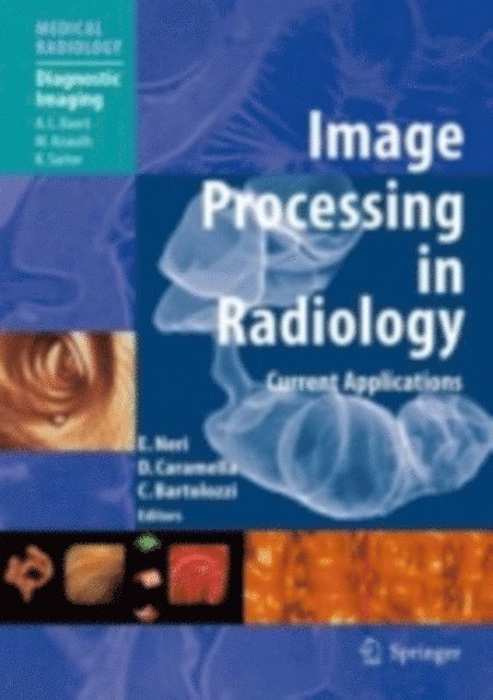 Carlo Bartolozzi, Davide Caramella, Emanuele Neri - Image Processing in Radiology, E-bok