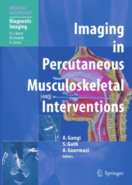 Ali Guermazi, Stephane Guth, Afshin Gangi - Imaging in Percutaneous Musculoskeletal Interventions, E-bok