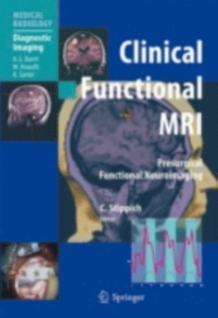 Christoph Stippich - Clinical Functional MRI, E-bok