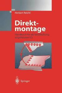 Direktmontage